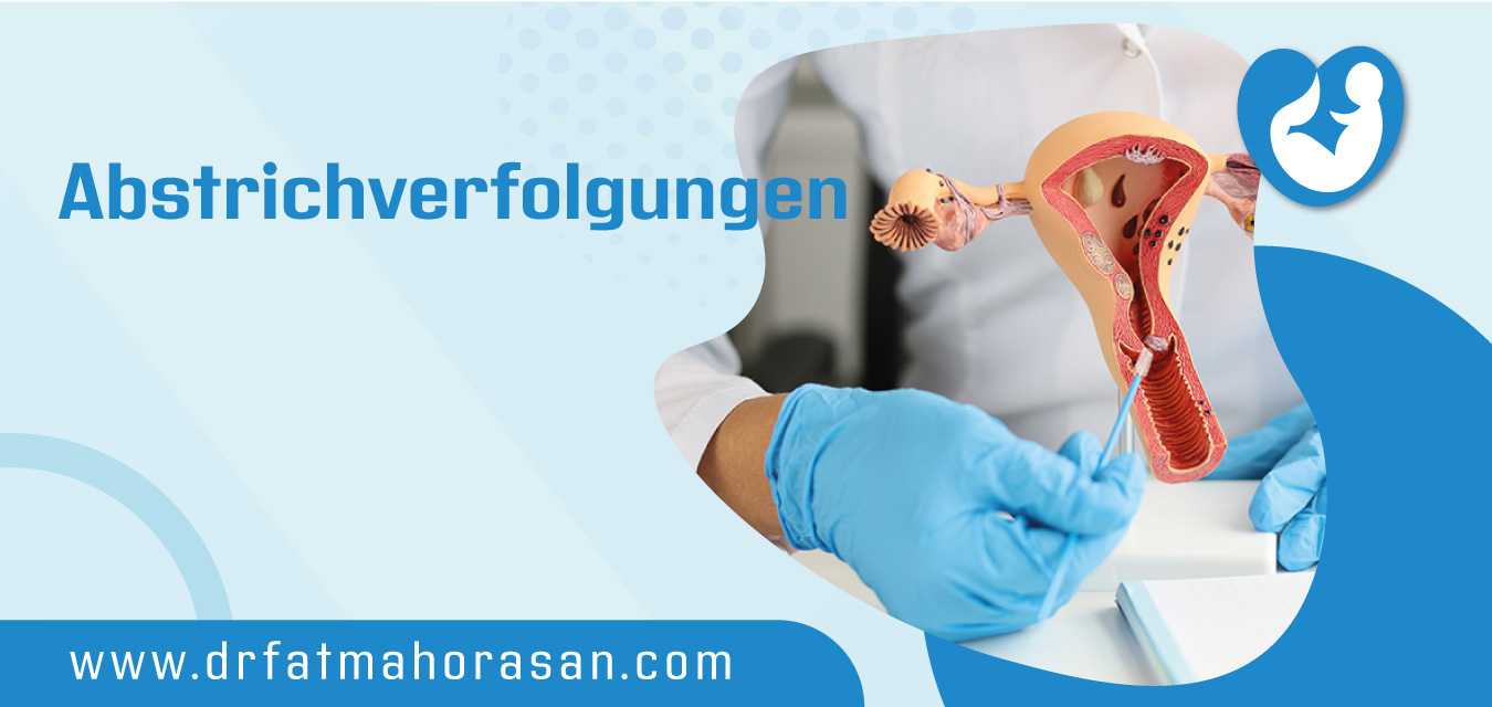 Abstrichverfolgungen