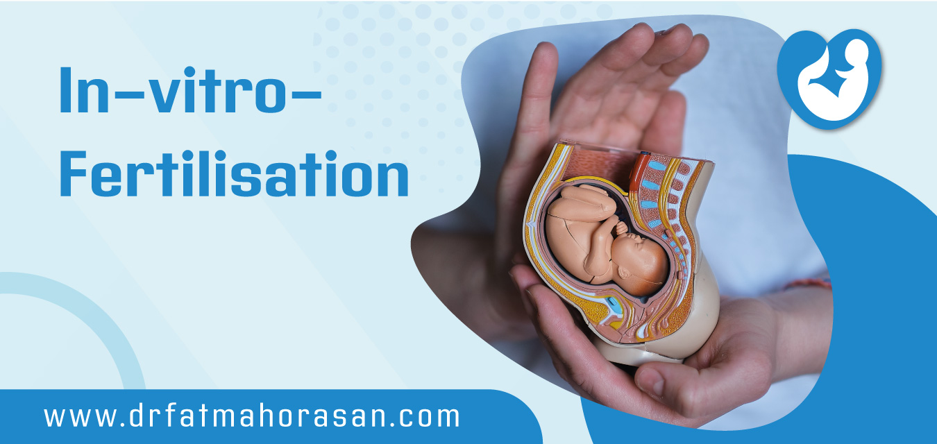 In-vitro-Fertilisation
