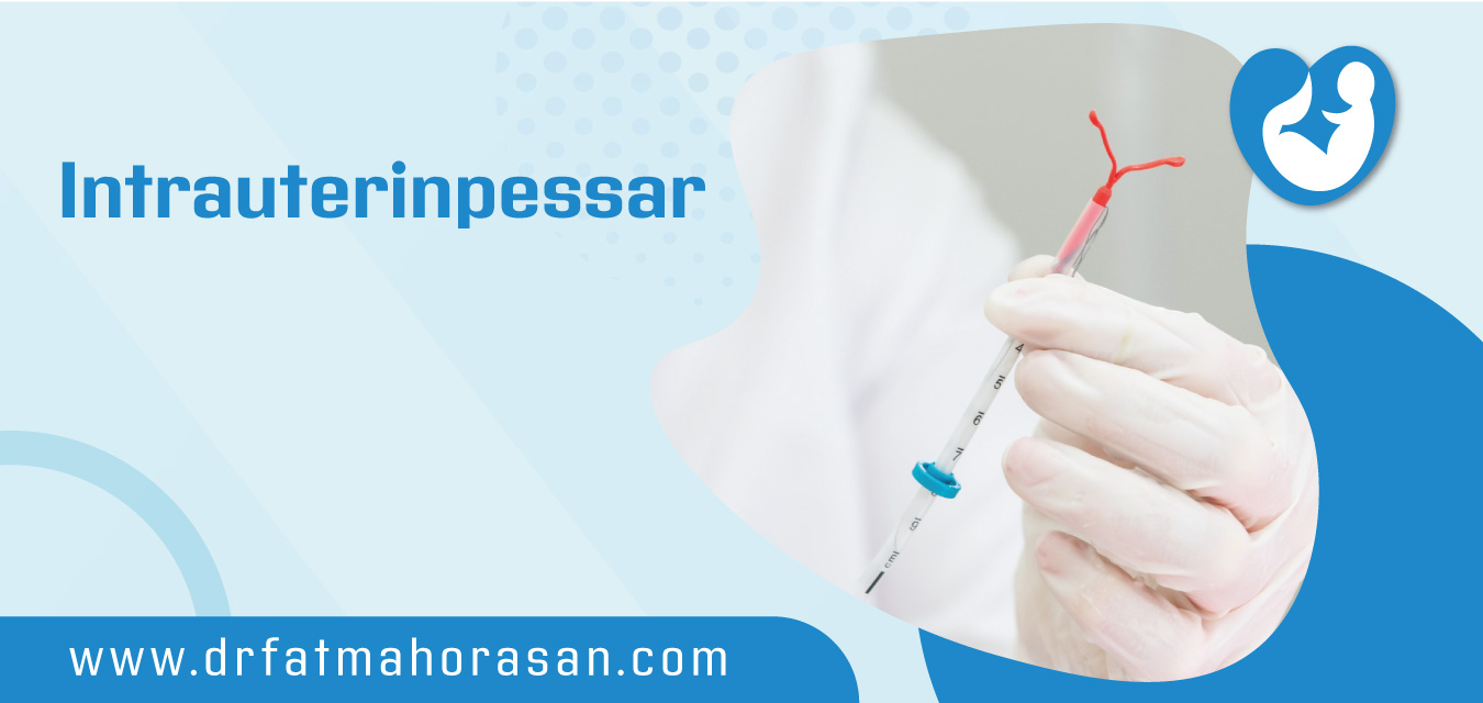 Intrauterinpessar