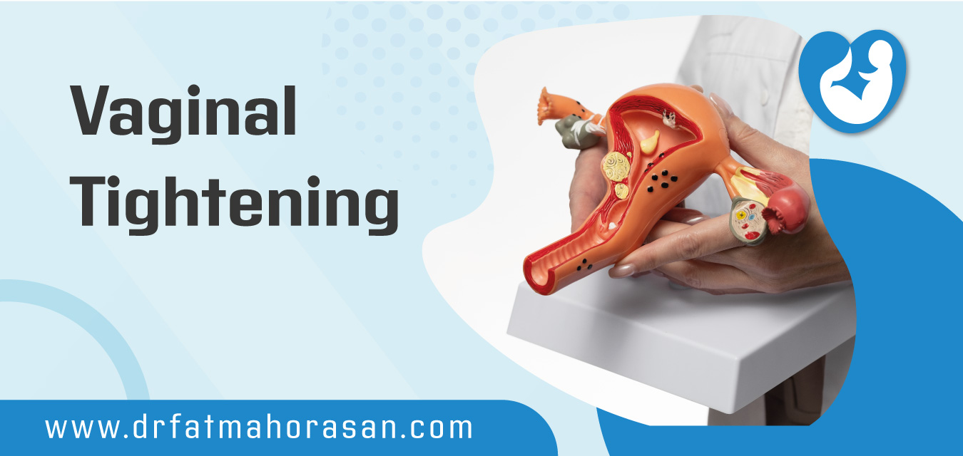 Vaginal Tightening