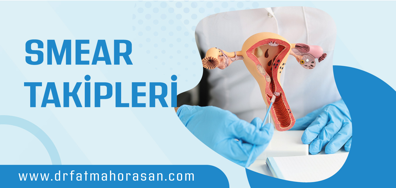Smear Takipleri